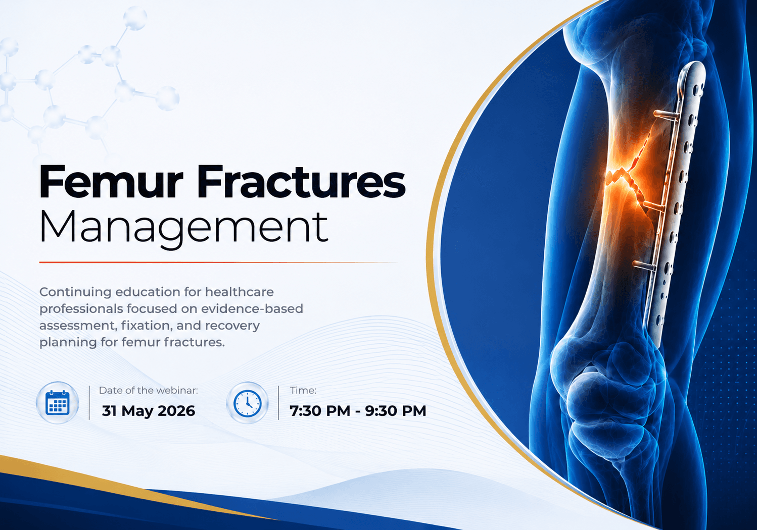 Femur Fractures Management